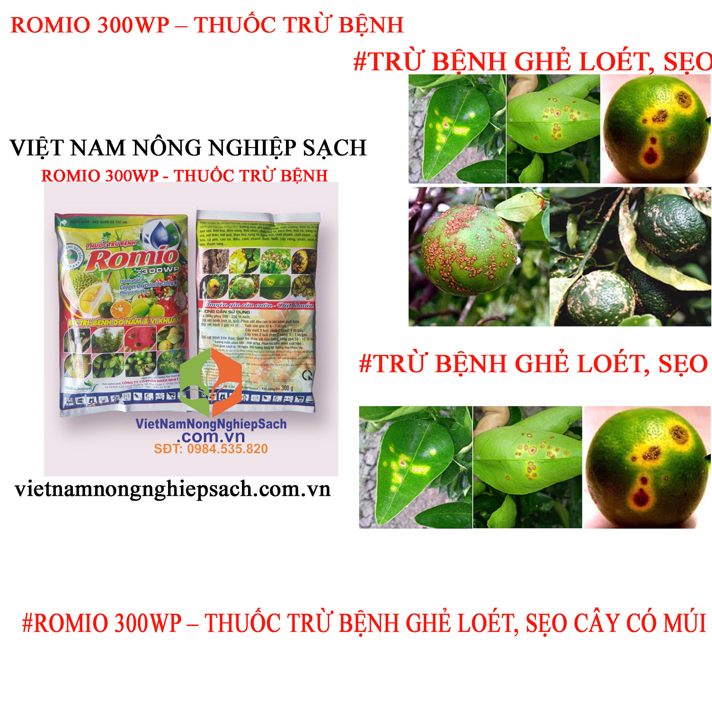 ROMIO-GHẺ-LOÉT-SẸO