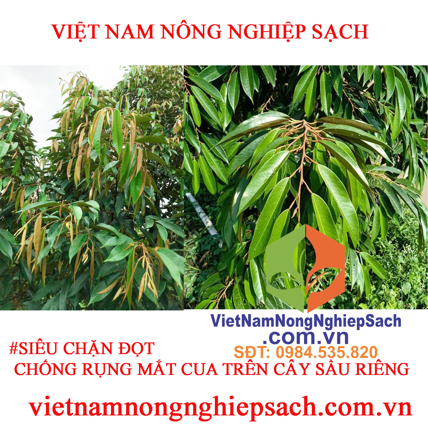 CHẶN-ĐỌT-SR